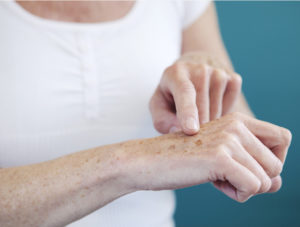 Пятна на руках