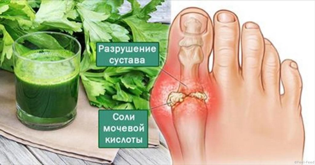 Боль в суставах, боль, косточка на ноге