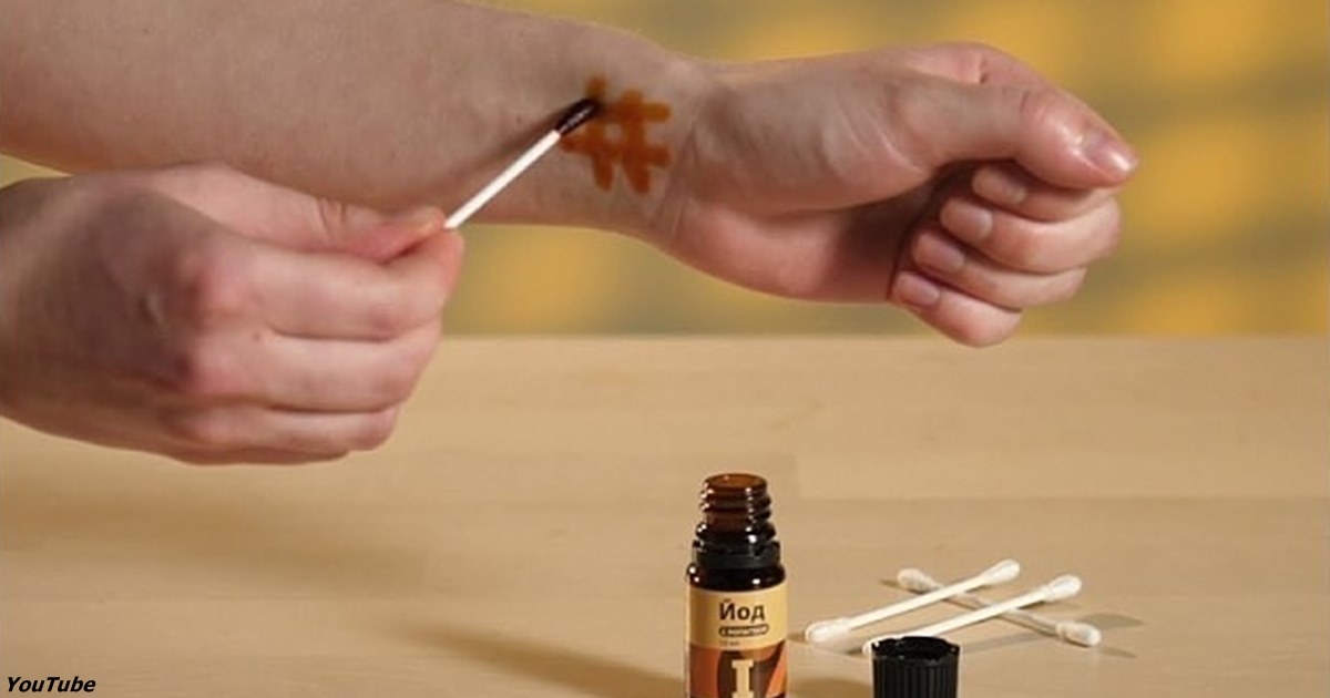 Йодовая сетка: нанесите на руку