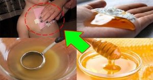 Обернутый в ткани имбирь выводит слизь из легких за 1 ночь!